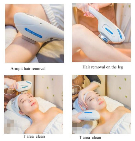 Portable IPL machine | hair removal | skin rejuvenation | pigmentation | vascular removal