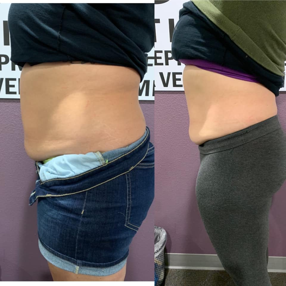 portable fat freezing machine for fat reduce weight loss treatment